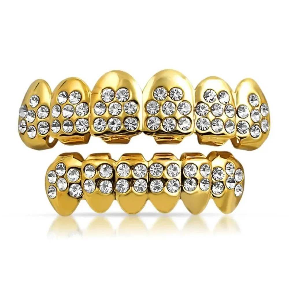 Standard Gold Grillz Set
